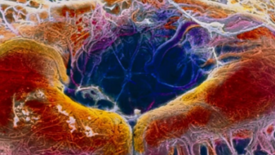“Bacterial Intrusion: Unraveling the Gut-Eye Connection in Genetic Retinal Diseases” “Bacterial Intrusion: Unraveling the Gut-Eye Connection in Genetic Retinal Diseases”